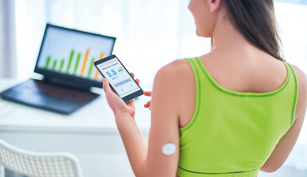 Actualización en los sistemas de monitorización continua de glucosa en diabetes