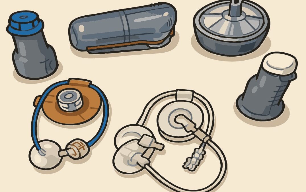 Avances en equipos de infusión para bomba de insulina, ¿qué hay de nuevo?
