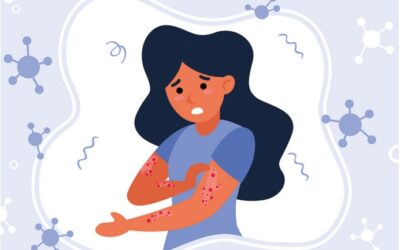 Diabetes y lesiones en la piel
