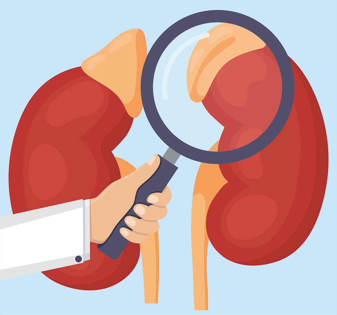 Glucocorticoides y diabetes ¿Cómo mediar en estas situaciones?