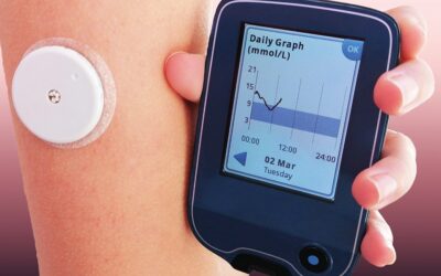 Novedades en sistemas de monitorización continua de glucosa