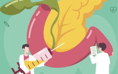 Papel del trasplante de páncreas en personas con diabetes