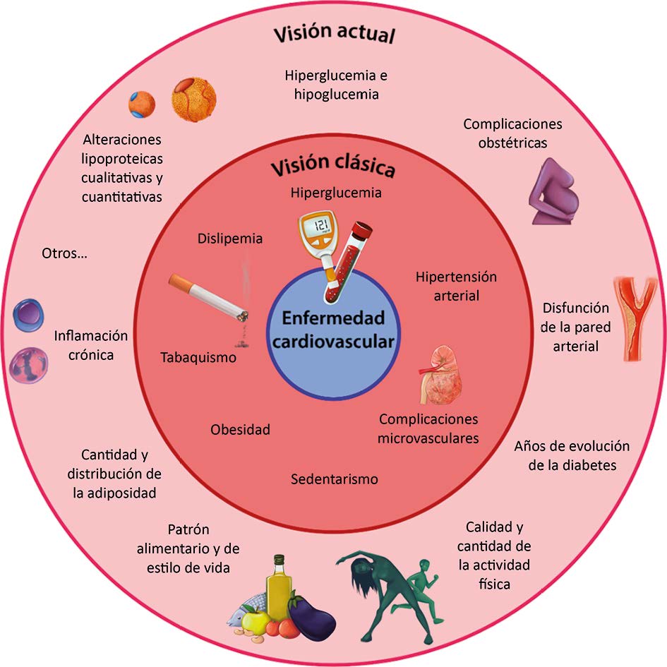 Riesgo cardiovascular en personas con diabetes tipo 1