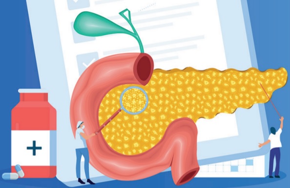 Diabetes Tipo 3C ¿Qué engloba y cómo tratarla?